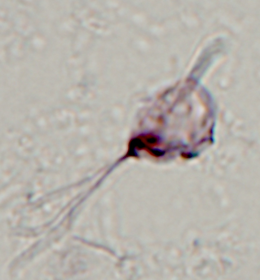P0018