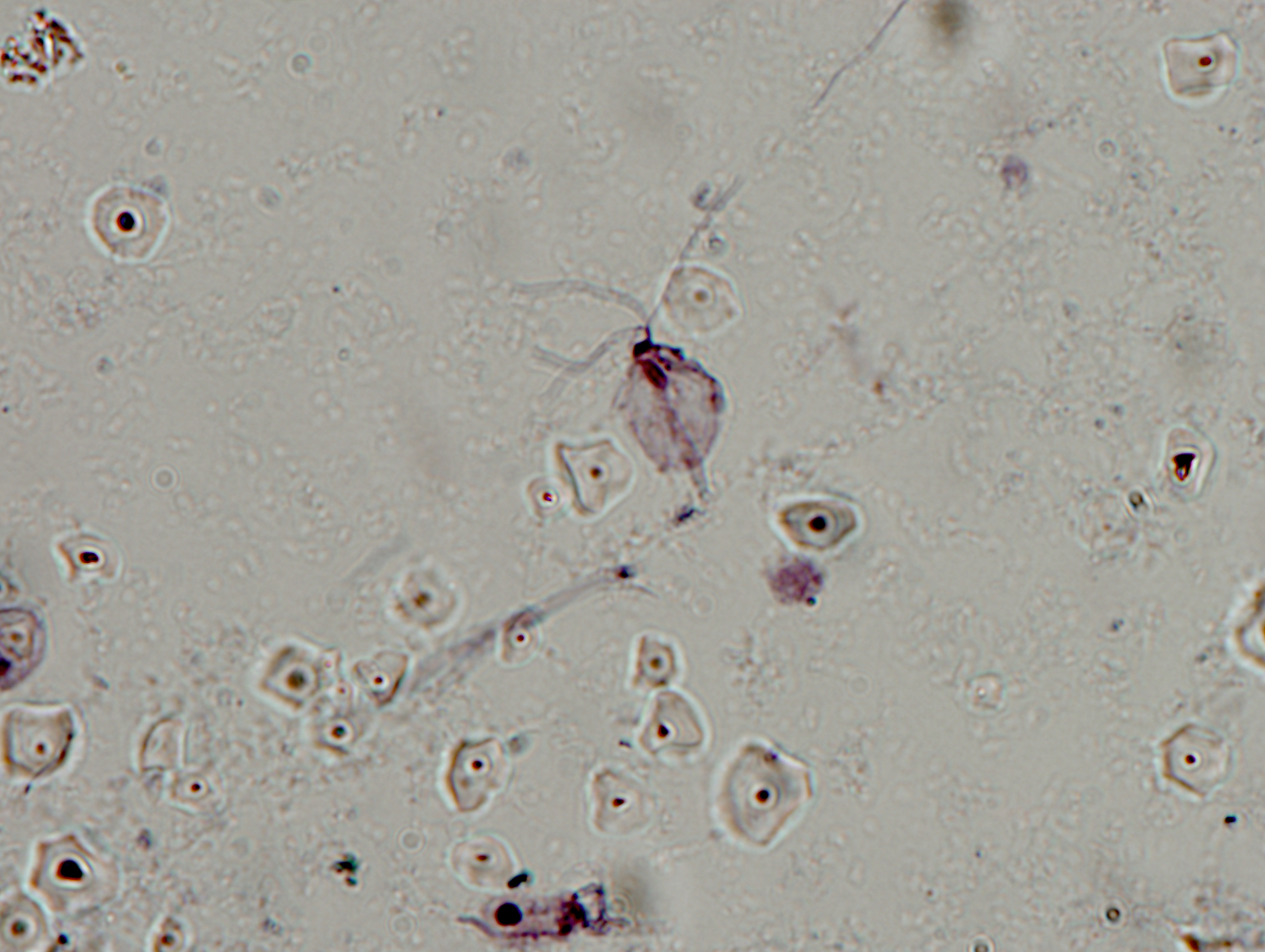 P0021